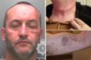 Scott Gorman (North Wales Police), left, and the victim's injuries